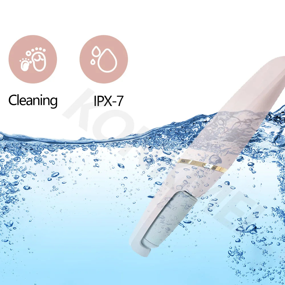 SoftTouch™ Callus Remover